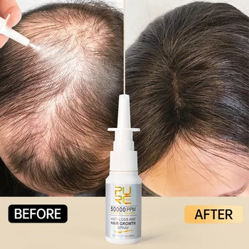 Greitas plaukų augimas Produktai nuo plaukų slinkimo Plaukų regeneracija Galvos odos gydymas Plaukų didinimas Mityba Vyrams 2023 Naujas