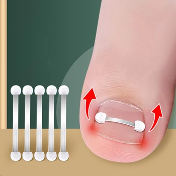 Įaugę kojų nagų korektoriaus įrankiai Pedikiūras Atkurti Įterpti Kojų pirštų nagų gydymas Profesionalus įaugusių nagų korekcijos pėdų priežiūros įrankis